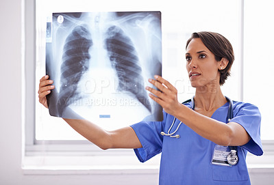 Buy stock photo X ray, hospital and woman doctor thinking of healthcare research, problem solving and review of skeleton and lung problem. Radiology professional, medical worker or surgeon with analysis or checking