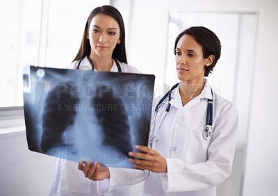 Buy stock photo Radiology, x ray or doctors with results in hospital, medical facility or clinic for lung exam or health. Women, people or healthcare workers with document, research or analysis of respiratory system