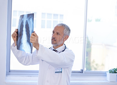 Buy stock photo Hospital, thinking and doctor with x ray for research, medical service or surgery review. Healthcare, radiology clinic and senior health worker with anatomy scan for analysis, diagnosis or consulting