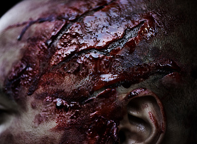 Buy stock photo A cropped shot of a man's wounded head covered in blood