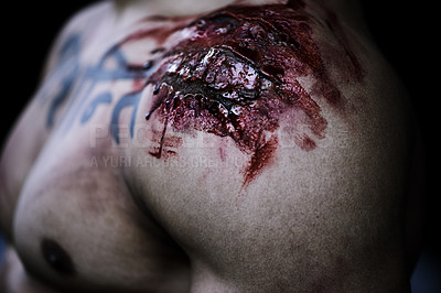 Buy stock photo A cropped shot of a man with a serious wound on his shoulder