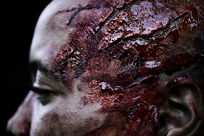 Buy stock photo A cropped shot of a man's wounded head covered in blood