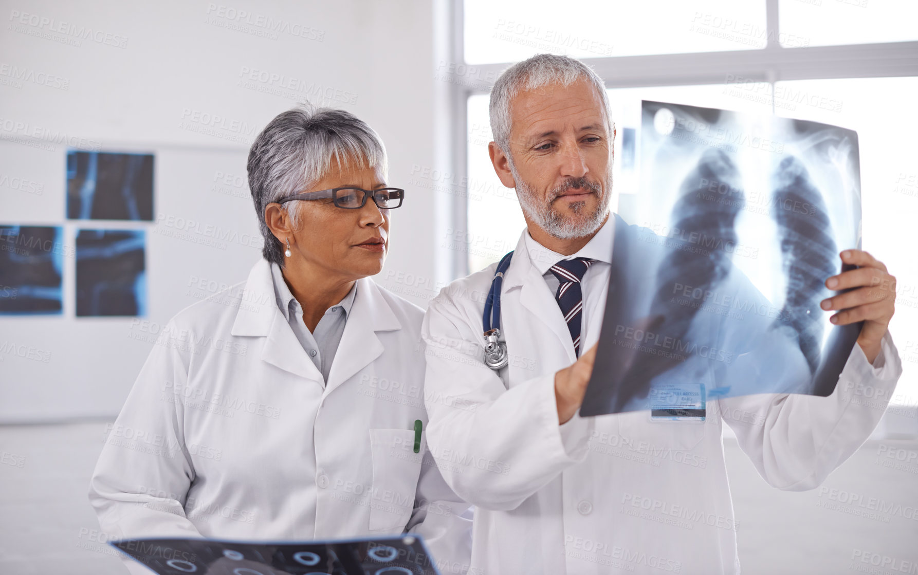 Buy stock photo Senior team of doctors, analysis of xray with surgery, people in radiology and cardiovascular health at clinic. Lung scan, old man and woman surgeon collaboration with assessment and problem solving