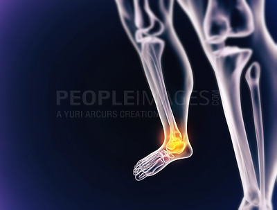 Buy stock photo A cgi view of an inflamed joint isolated on blue 