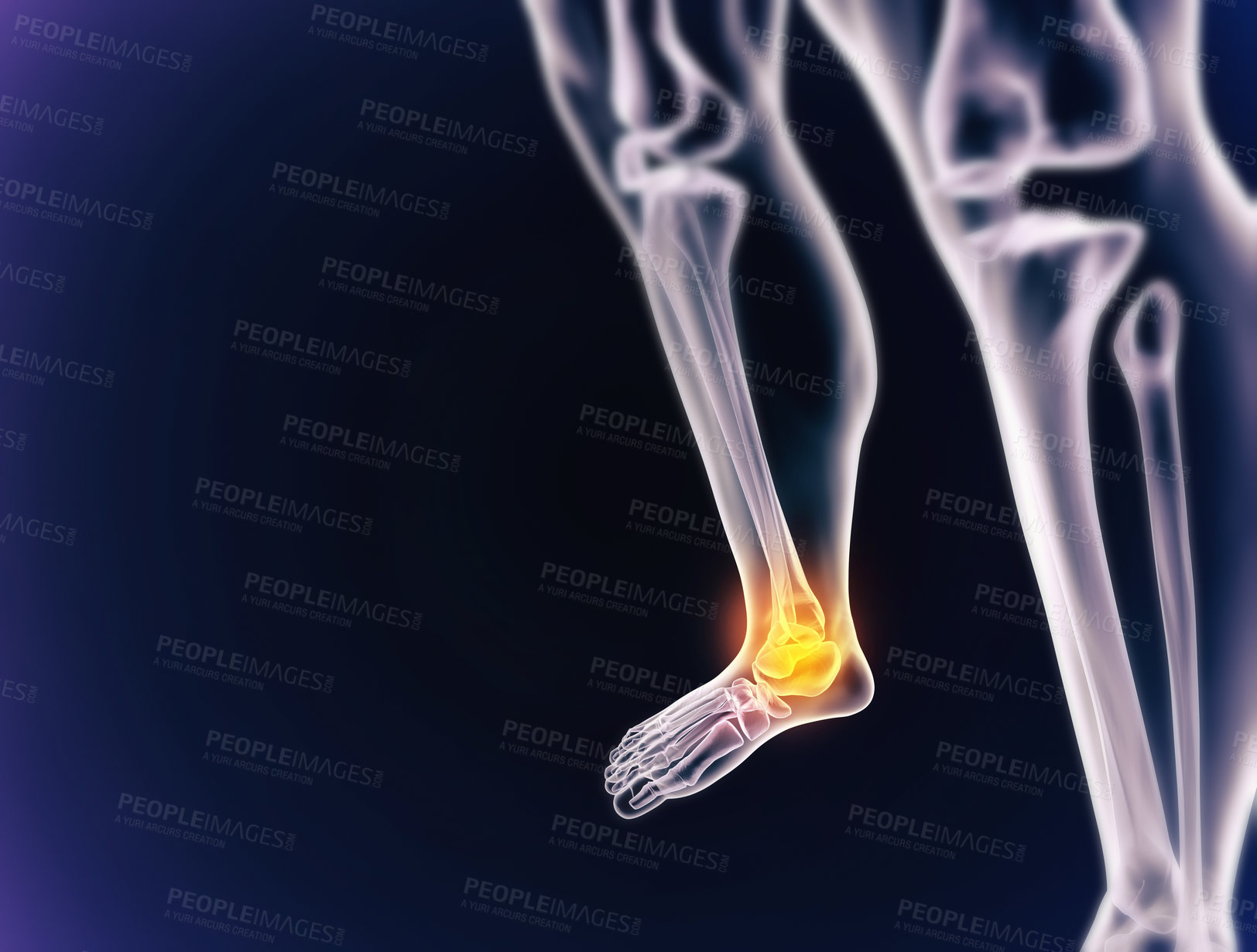 Buy stock photo A cgi view of an inflamed joint isolated on blue 