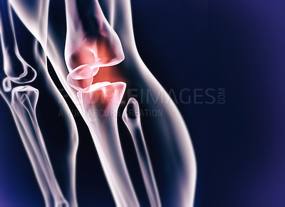 Buy stock photo A cgi view of an inflamed joint isolated on blue 