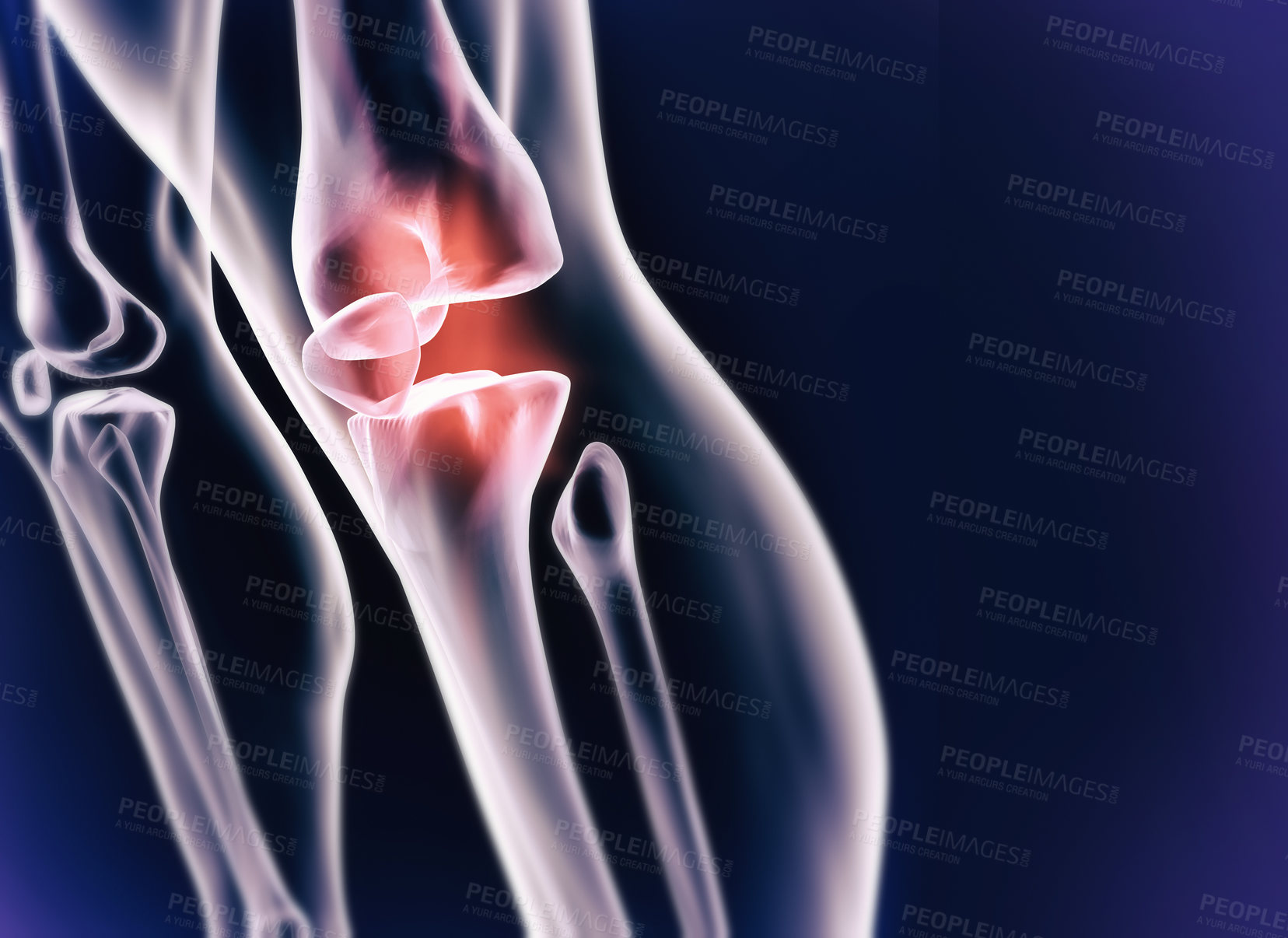 Buy stock photo A cgi view of an inflamed joint isolated on blue 