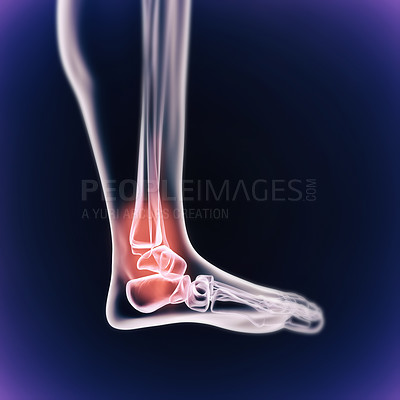 Buy stock photo A cgi view of an inflamed joint isolated on blue 