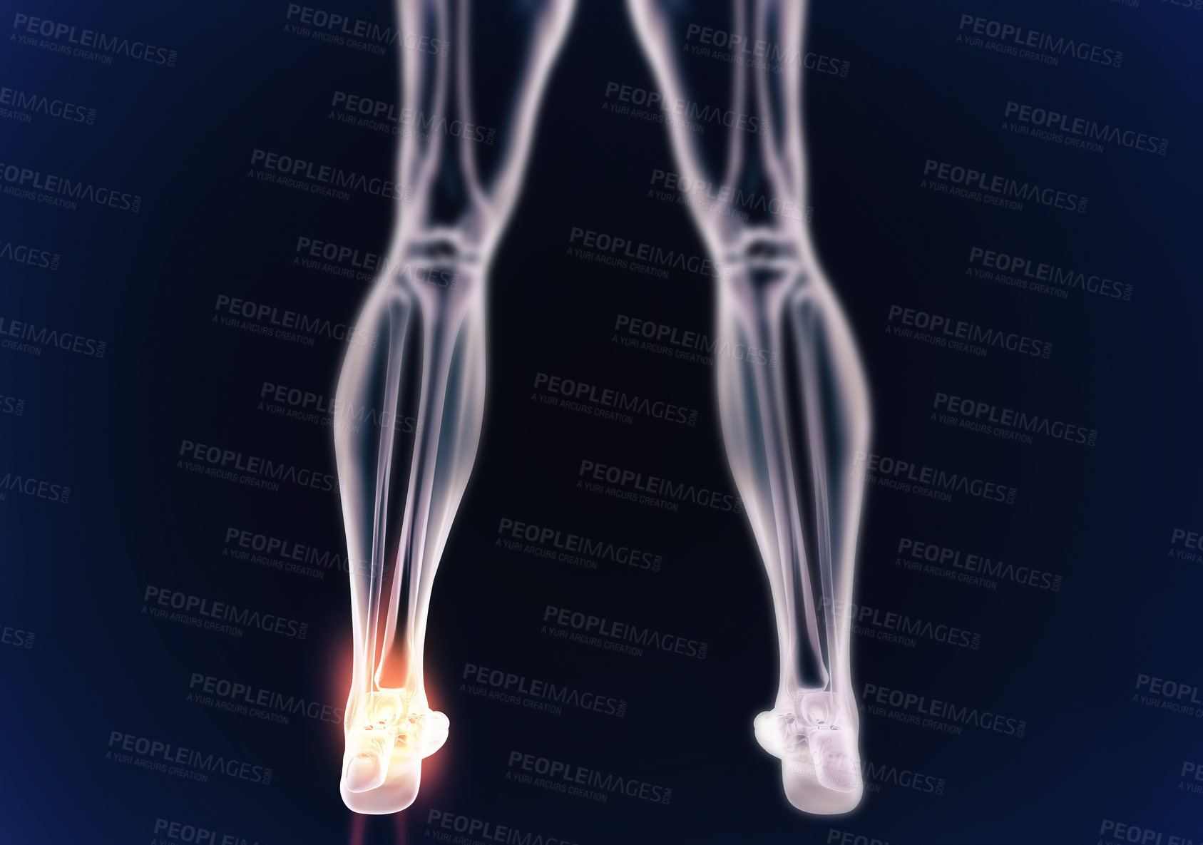 Buy stock photo A cgi view of an inflamed joint isolated on blue 