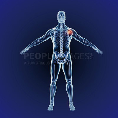 Buy stock photo Shoulder pain, skeleton and graphic of body for xray, exam and analysis in medical overlay. 3D of human anatomy, radiology and red illustration of injury or physiotherapy on a dark or blue background