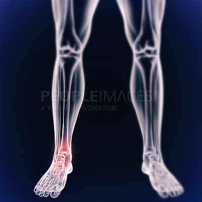 Buy stock photo A cgi view of an inflamed ankle joint isolated on blue