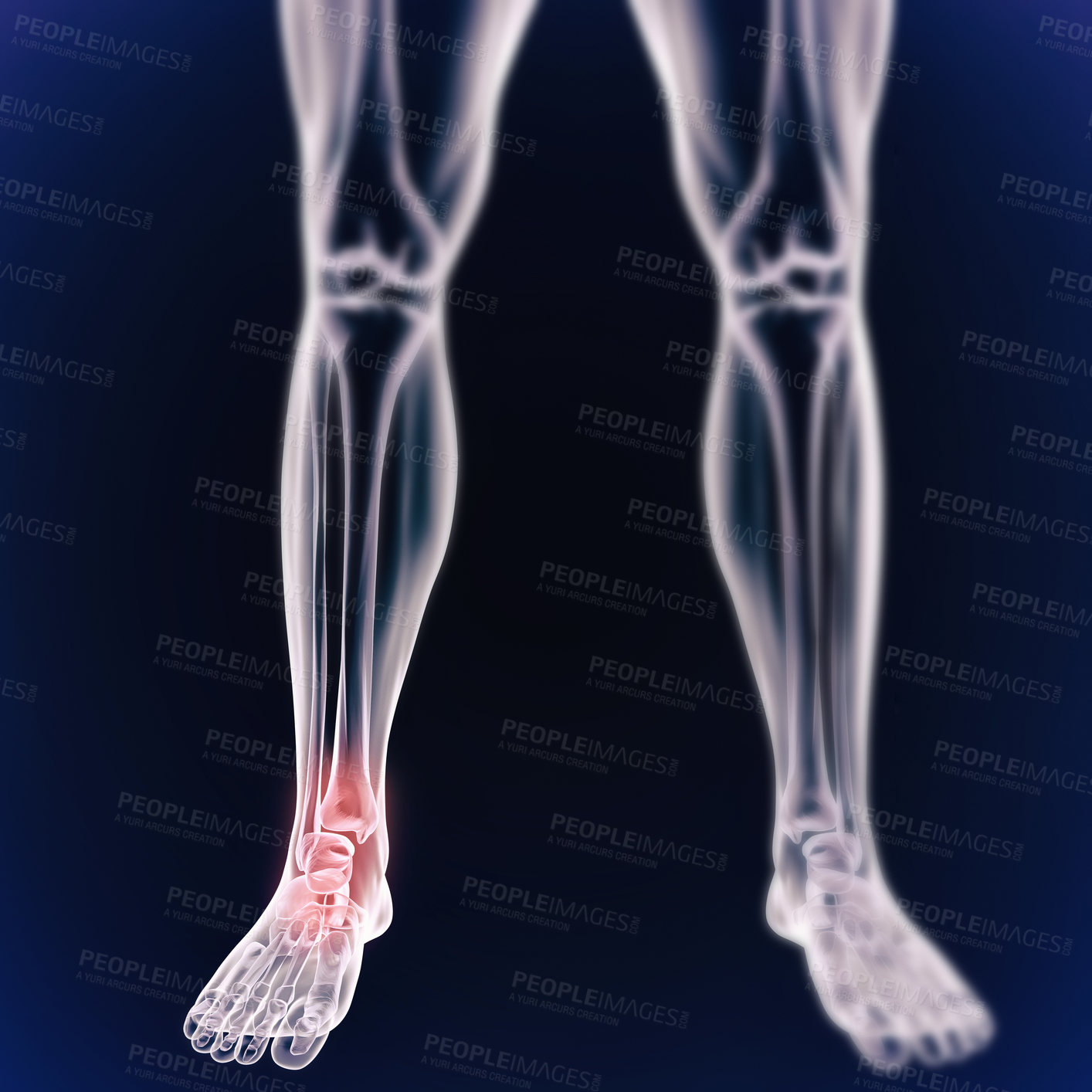 Buy stock photo A cgi view of an inflamed ankle joint isolated on blue