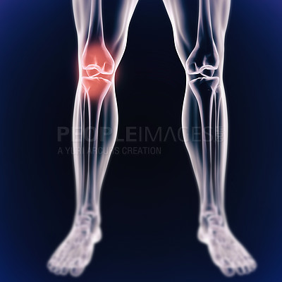 Buy stock photo A cgi view of an inflamed joint isolated on blue 