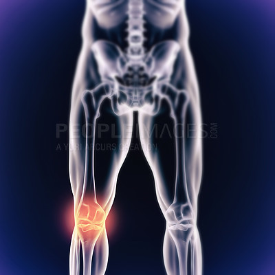 Buy stock photo A cgi view of an inflamed joint isolated on blue 