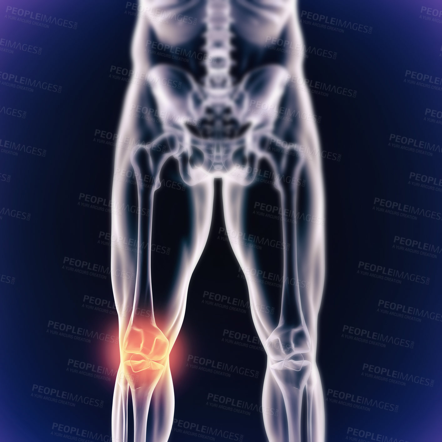 Buy stock photo A cgi view of an inflamed joint isolated on blue 