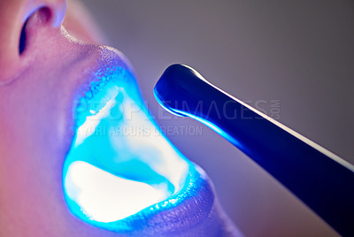 Buy stock photo Closeup, child and dentist with tools in mouth for gum disease, oral hygiene and dental inspection. Consultation, orthodontics and young girl with ultraviolet light for cleaning, treatment and care 