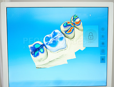 Buy stock photo Shot of a scan of teeth for cavities on a monitor