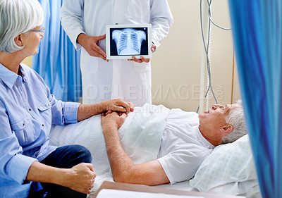 Buy stock photo Shot of a sick man in a hospital bed being shown an xray of his chest while his wife holds his hand