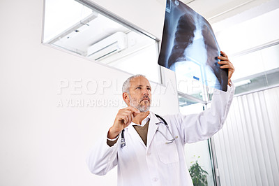 Buy stock photo Xray, radiology and thinking with doctor in hospital for medicine, healthcare and tumor detection. Medical, insurance and lung cancer with mature man and mri scan for pneumonia or disease screening