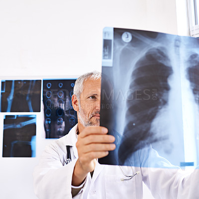 Buy stock photo Shot of a mature male doctor looking at a x-ray image at a hospital
