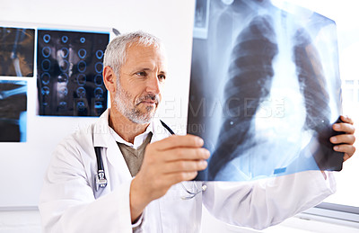 Buy stock photo Senior doctor, analysis and xray for ideas, health service and orthopedic man with thinking for lung surgery. Medicine, radiology and study for bronchitis and problem solving with surgeon in clinic
