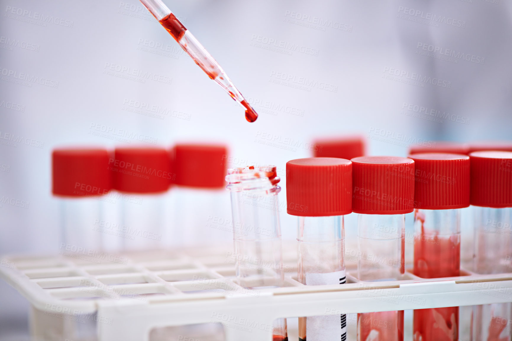 Buy stock photo Blood test, sample for science in laboratory, research and studying monkeypox virus, infection and viral disease. Medical study, tube and analysis of pathology, biology and immunity in dna innovation