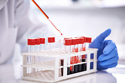 Buy stock photo Blood study, hands and science in laboratory, research and studying monkeypox virus, infection and disease. Medical person test, tube and analysis of pathology, biology and immunity in dna innovation