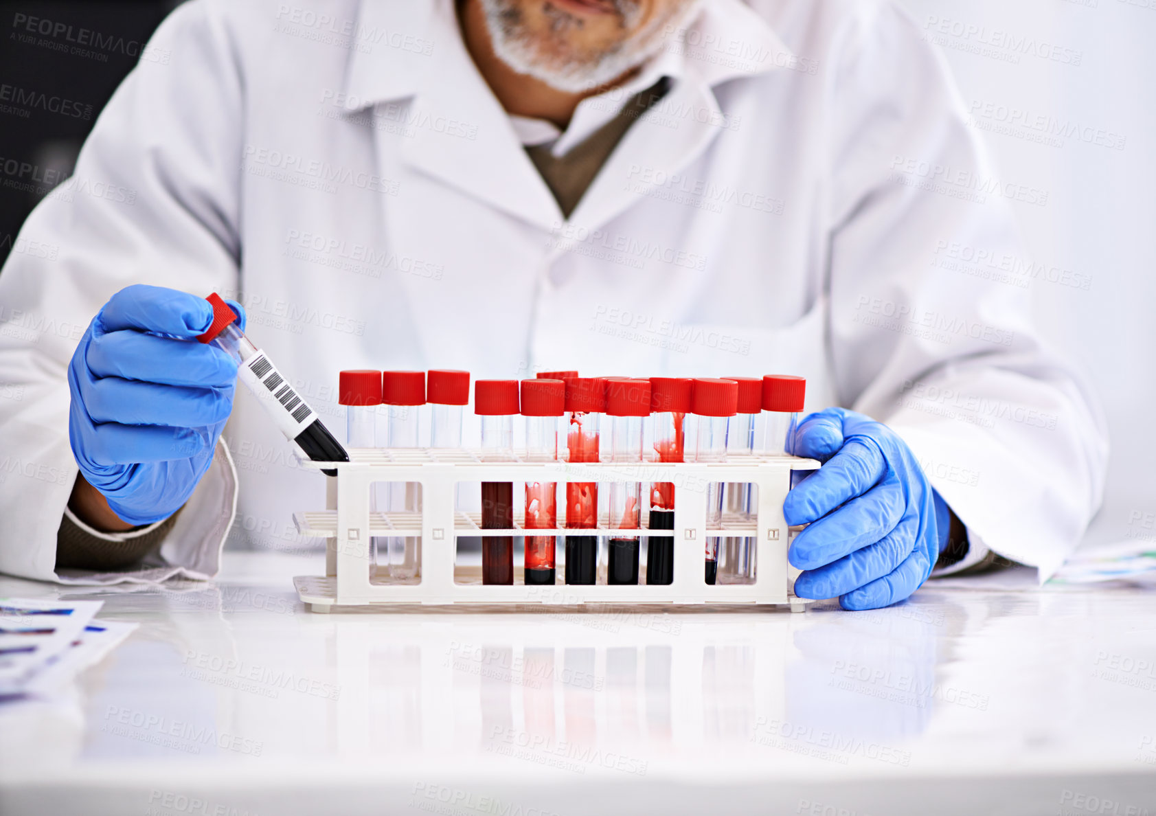 Buy stock photo Blood study, hands and scientist in laboratory for research, studying and monkeypox virus, infection or disease. Medical test, tube and pathology, biology or immunity in dna innovation with doctor