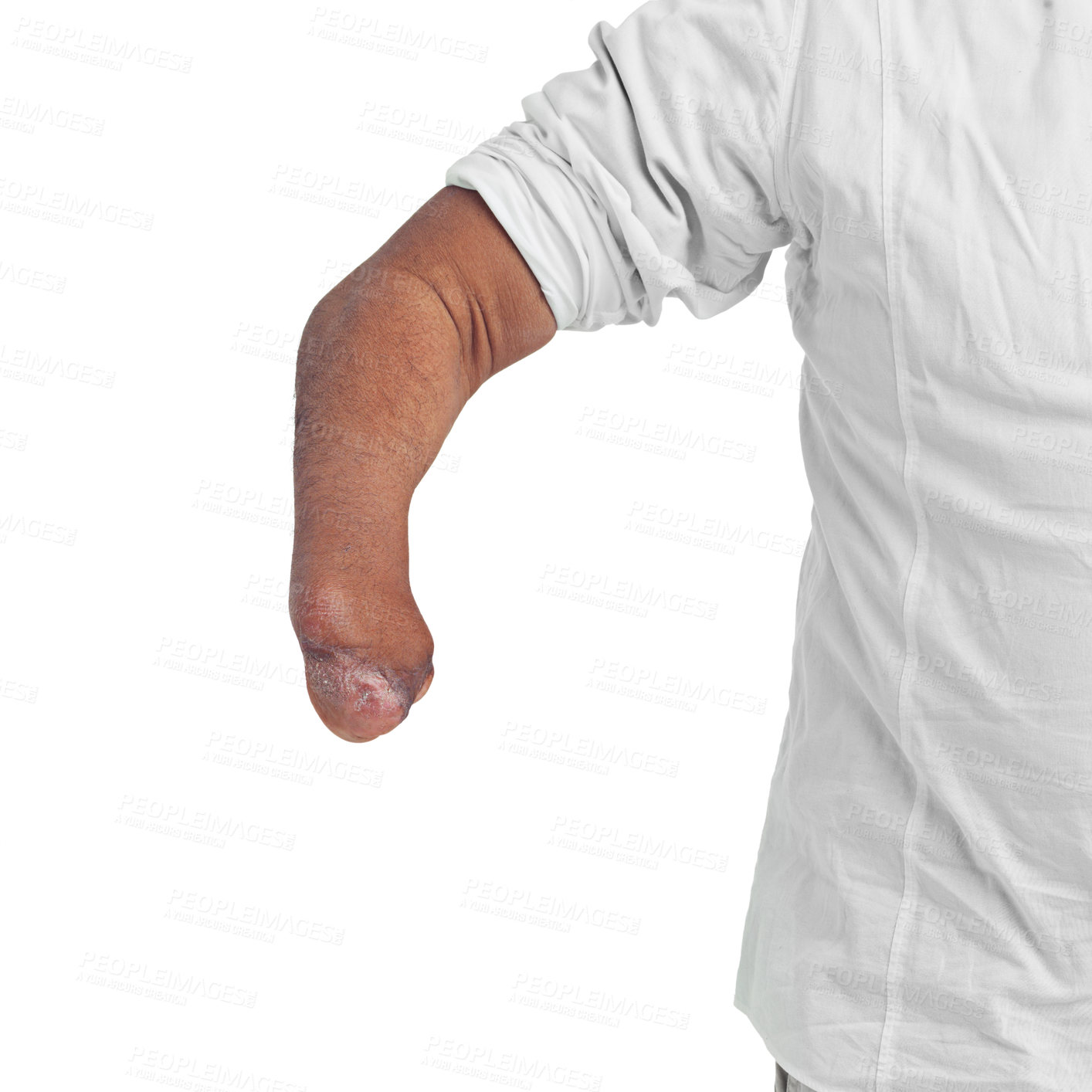 Buy stock photo Disability, unique and arm amputee of a man with a injury showing forearm with mockup. Isolated, disabled model and white background of a male person pose with a different body and mock up space