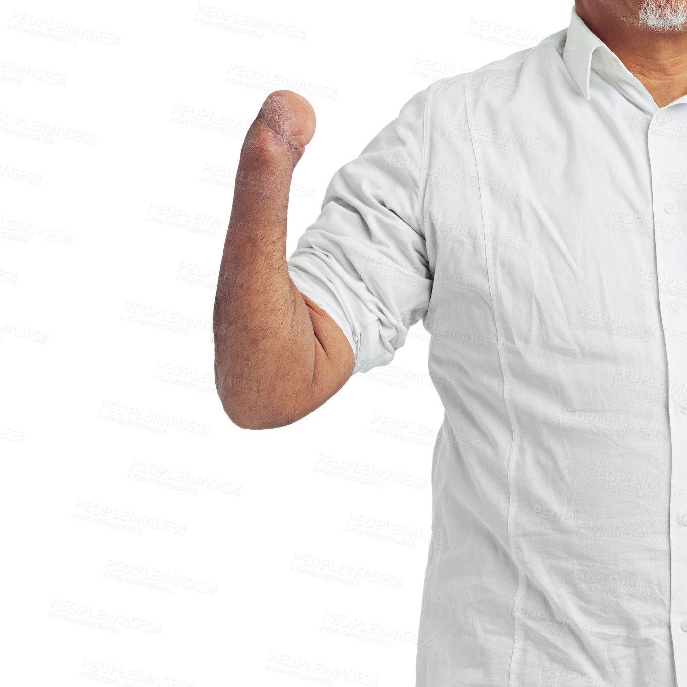 Buy stock photo Disability, injury and arm of an injured amputee isolated on a white background in studio. Disabled, defect and body limb of a disabled man or person showing a forearm stump on a studio background