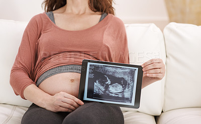 Buy stock photo Shot of a young pregnant woman showing her ultrasound on a digital tablet
