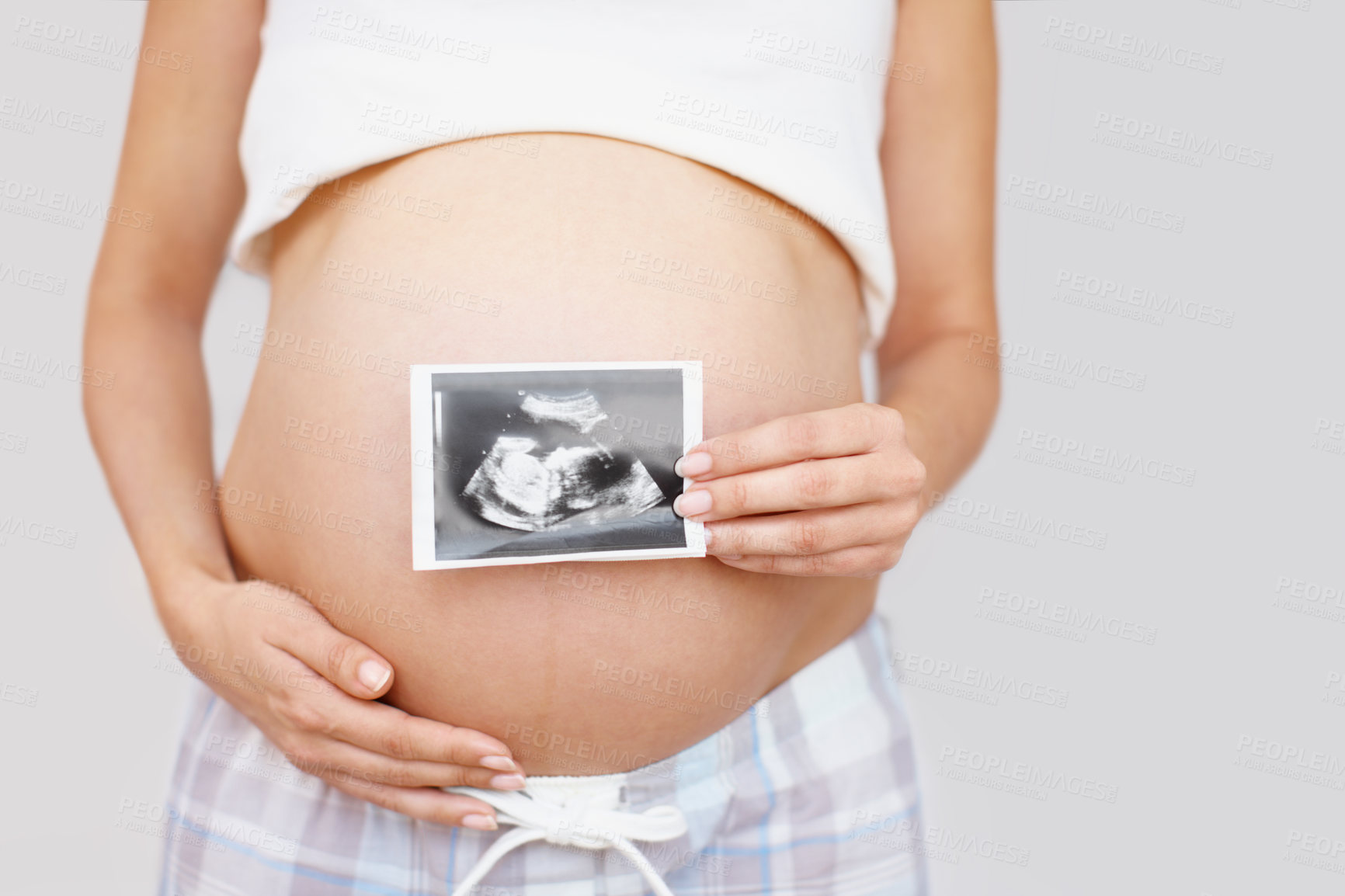 Buy stock photo Hands, pregnant woman and sonogram picture on stomach for baby growth, maternity and ultrasound scan. Mother, pregnancy and photo on abdomen closeup for prenatal health on white studio background