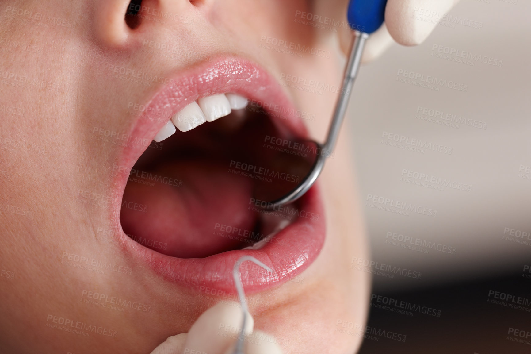 Buy stock photo Closeup of female patient during dental treatment