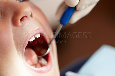 Buy stock photo Closeup of young child with mouth open at dentist office