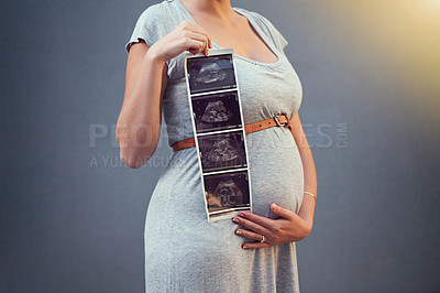 Buy stock photo Mother, pregnant and stomach ultrasound in studio for maternity shoot, album and baby shower. Woman, expecting and sonogram isolated on gray background for gender reveal, surrogacy and legal adoption