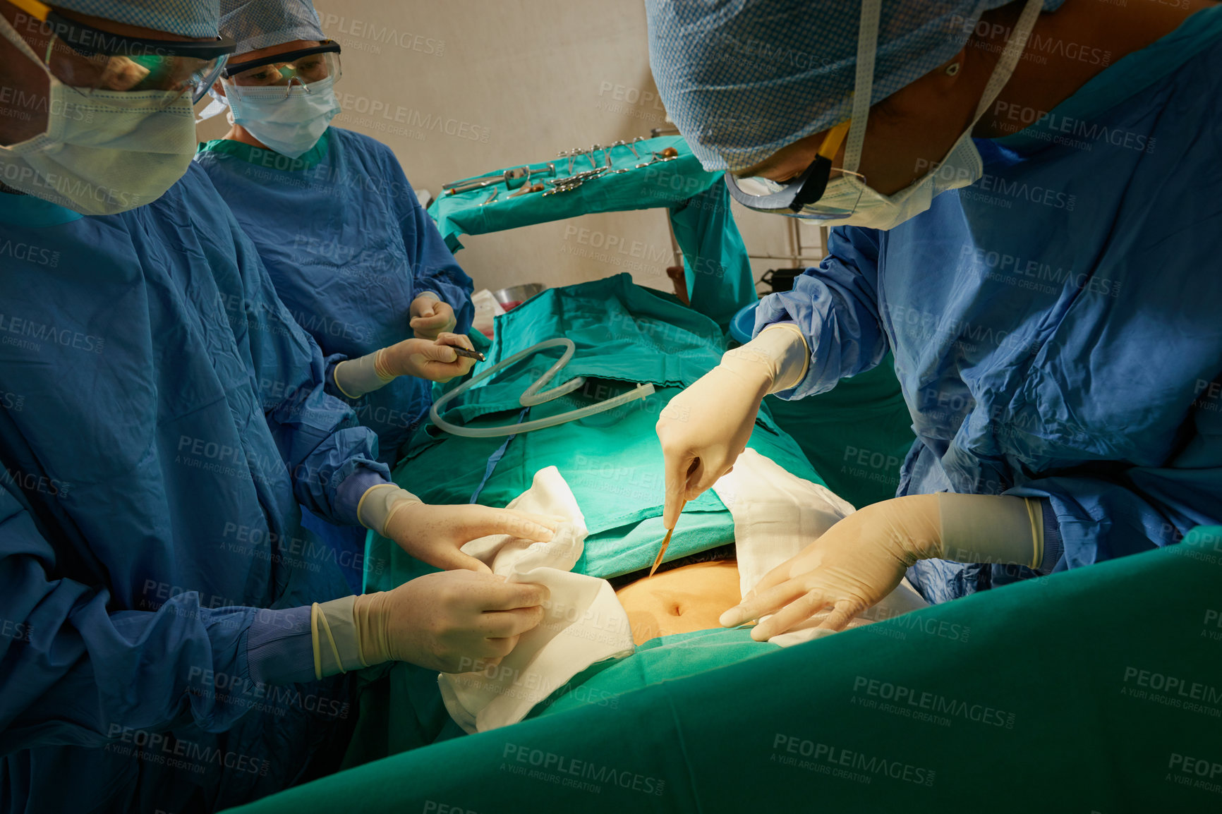 Buy stock photo Shot of a surgeon making an incision with a scalpel on a patient