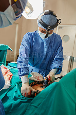 Buy stock photo Shot of a surgeon using a defibrillator on a patient during surgery