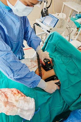 Buy stock photo Shot of a surgeon using a defibrillator on a patient during surgery