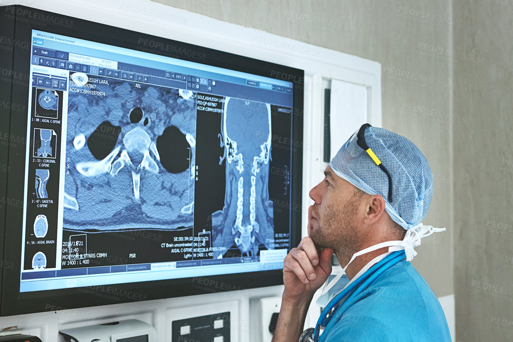 Buy stock photo Surgeon, man or thinking with scan in hospital for surgery planning, tumor progress or assessment. Medical scrubs, doctor and screen with CT imaging in operating room for operation solution or review