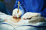 Making the perfect incision
