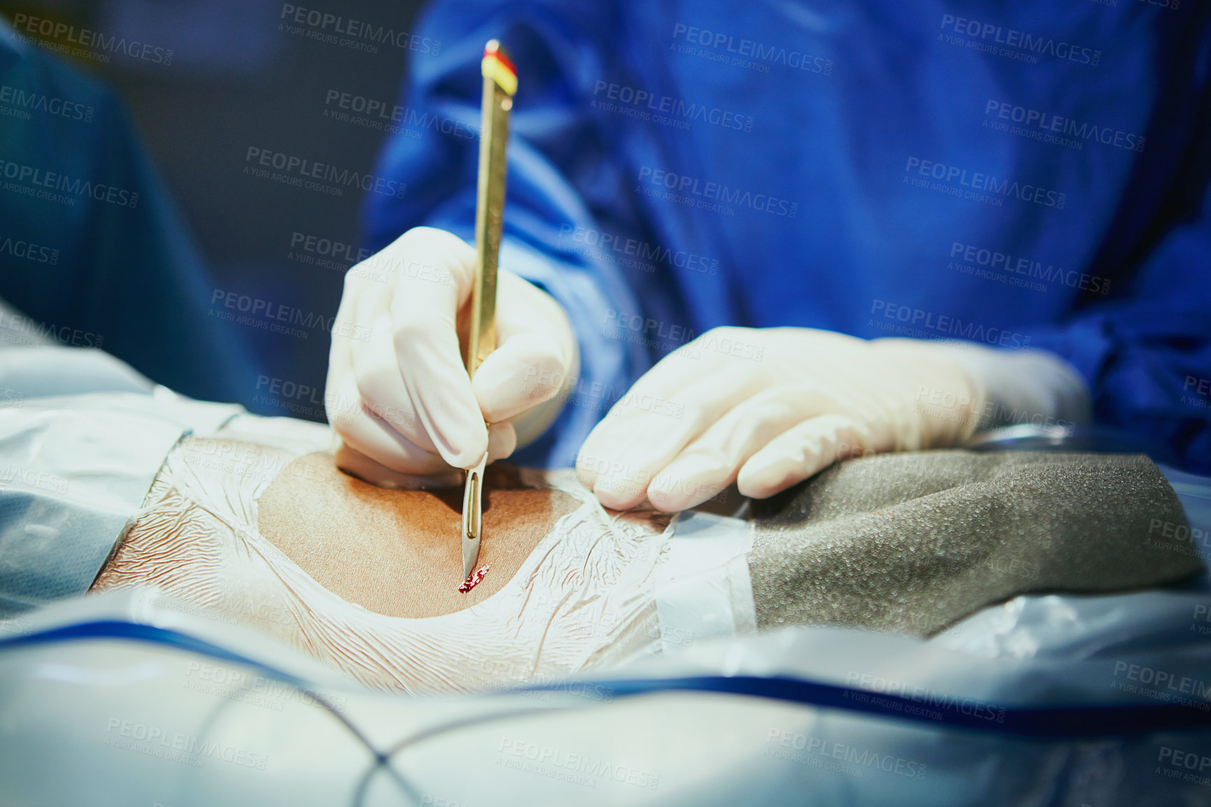 Buy stock photo Cropped shot of a surgeon in an operating room