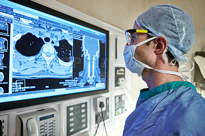 Buy stock photo Shot of a surgeon looking at a patient's medical scan