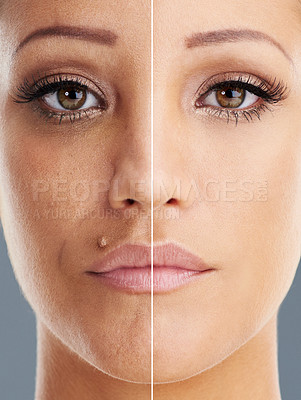 Buy stock photo Comparison, portrait or face of woman in studio for skincare, makeup or collagen treatment. Person, closeup or dermal fillers in skin for anti aging, transformation or results on gray background