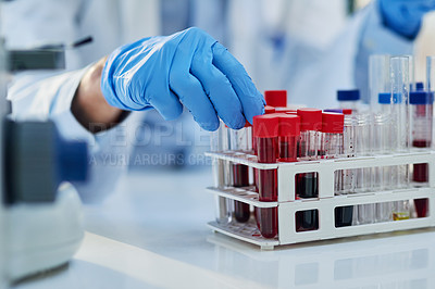 Buy stock photo Science, blood test and hands of person with sample for biotech engineering, pathology and hematology research. Laboratory, exam and scientist with glucose analysis, development or medical study.