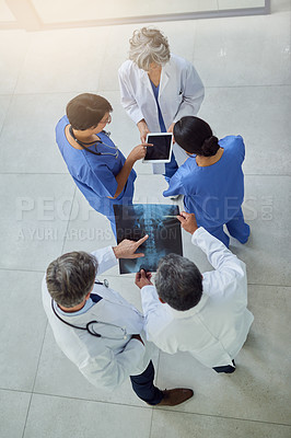 Buy stock photo Top view, doctors and nurses with tablet, xray and app for medical report or research. Team, technology and planning for surgery, health and wellness with discussion for help and hospital support