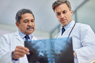 Buy stock photo Orthopedic doctors, hospital and x ray team, diagnose and discussion with communication. Surgeons, collaboration and healthcare for patient, medicine and professional speak for picture medical advice
