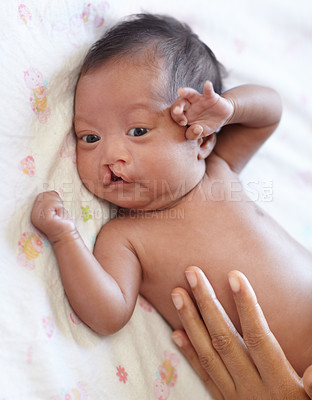Buy stock photo A young mother placing her hand on her baby with a cleft palate