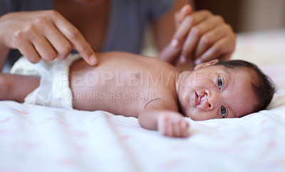 Buy stock photo Care, portrait and a baby with a cleft palate being changed, playing and hands of a mother with love. Family, health and a newborn child with a disability and a mama or parent for childcare