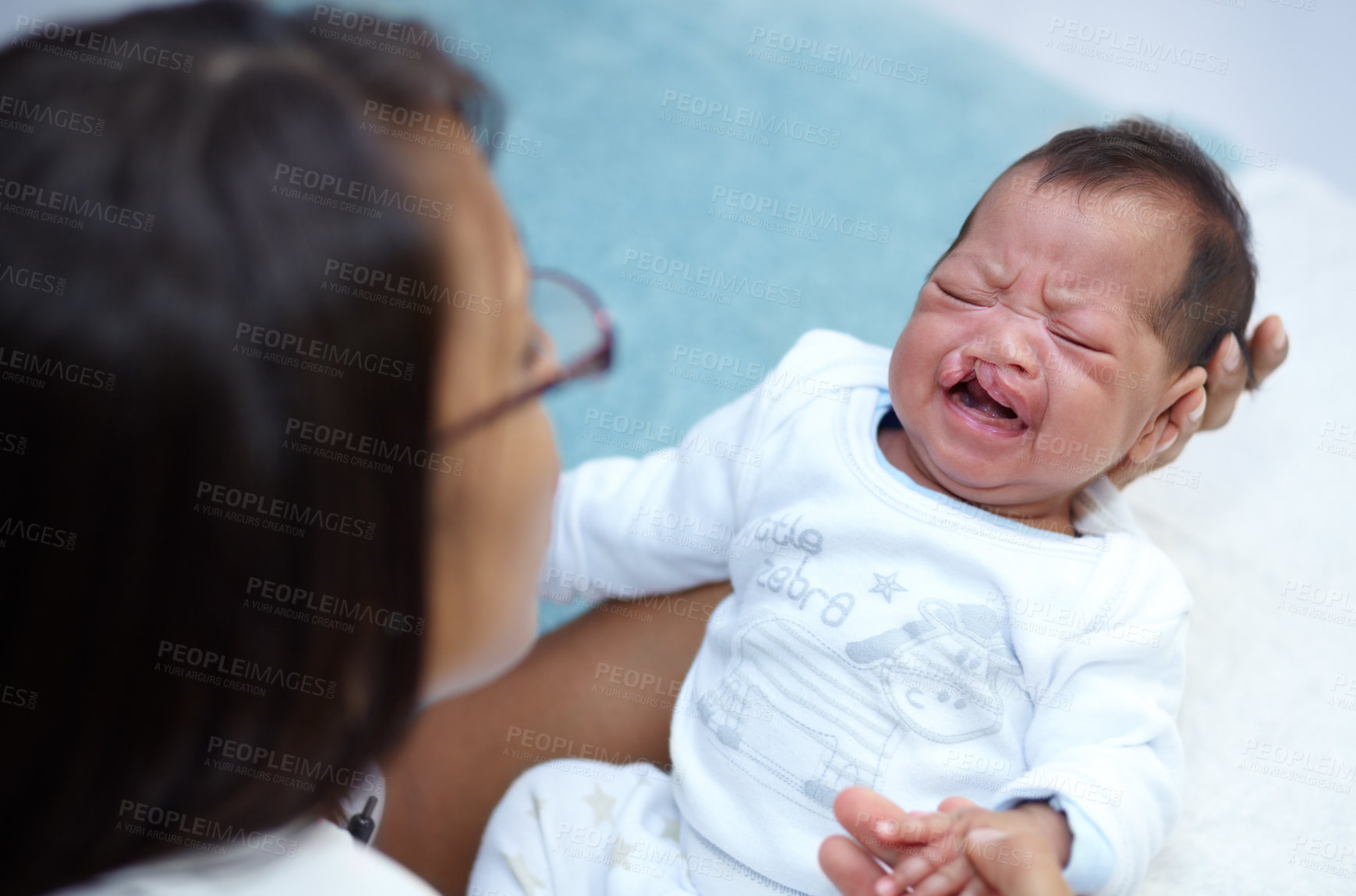 Buy stock photo Crying, mother and a baby with a cleft lip in the bedroom of the home together for love or care from above. Healthcare, medical and child with a disability in the arms of a mom in a house for comfort