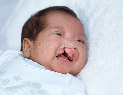 Buy stock photo Closeup of a baby with a cleft lip or palate. A newborn girl born with an opening in the roof of the mouth. An infant with a birth defect crying while lying on her back in a hospital bed or cot
